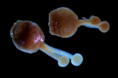 gynoecium