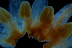 infrastaminal scales