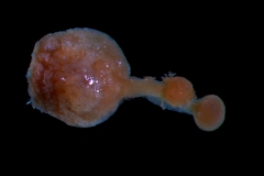 gynoecium