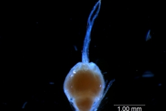 gynoecium