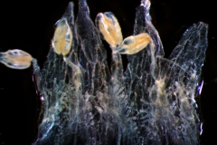 infrastaminal scales