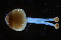 gynoecium