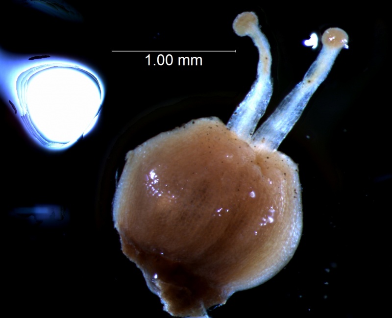gynoecium