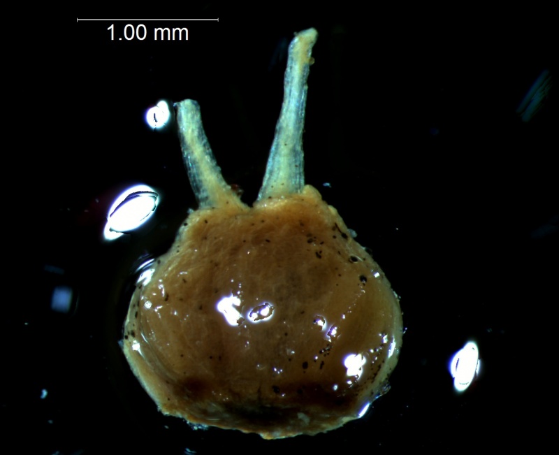 gynoecium