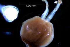 gynoecium