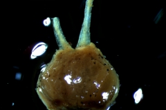 gynoecium