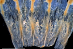 infrastaminal scales