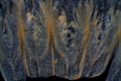 infrastaminal scales