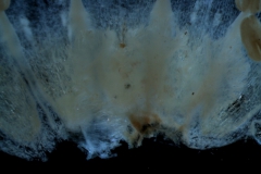infrastaminal scales