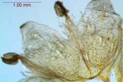 infrastaminal scales