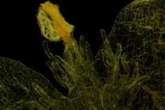 infrastaminal scales and stamen