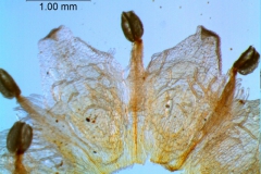 infrastaminal scales