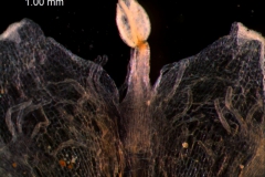 infrastaminal scale
