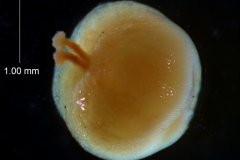 gynoecium