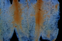 infrastaminal scales