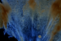 infrastaminal scales
