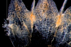 infrastaminal scales