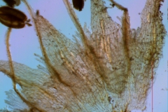 infrastaminal scales
