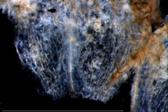 infrastaminal scales