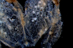 infrastaminal scales