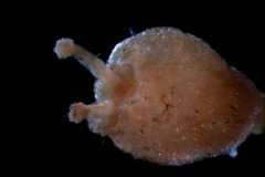 gynoecium