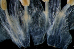 infrastaminal scales