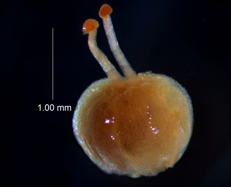 gynoecium