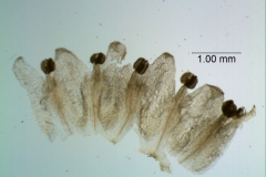 corolla, dissected