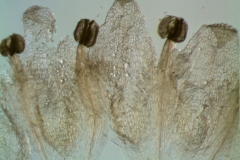 corolla, dissected