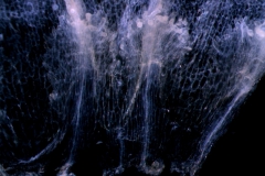 infrastaminal scales