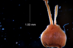 gynoecium