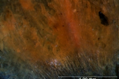 infrastaminal scales