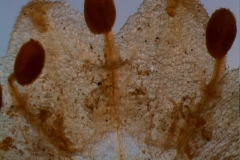infrastaminal scales
