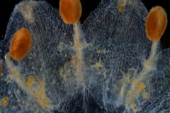 infrastaminal scales