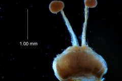 gynoecium