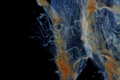 infrastaminal scales