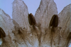 infrastaminal scales