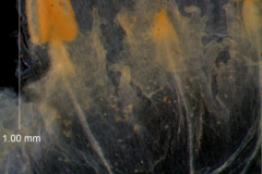 infrastaminal scales