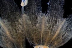 infrastaminal scales