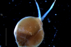gynoecium