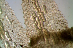 laticifers in corolla lobes