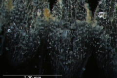 infrastaminal scales