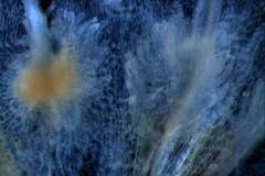infrastaminal scales