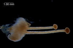 gynoecium