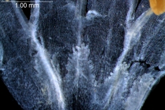 infrastaminal scales