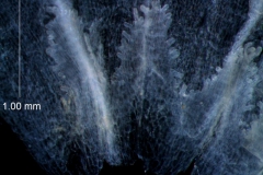 infrastaminal scales