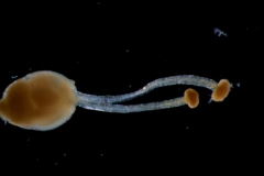 gynoecium
