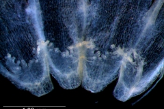 infrastaminal scales