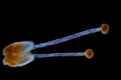 gynoecium