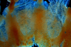 infrastaminal scales